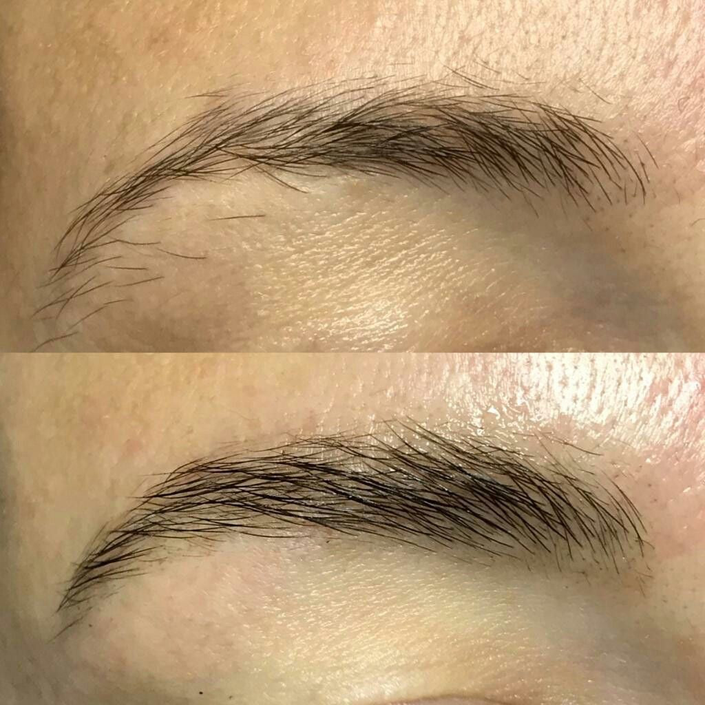 Serum Renacer